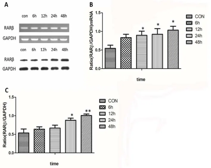 Fig 3. Time-related changes in expression of RARβ mRNA and protein. A significant increase in the RARβ band intensity was detected for both mRNA (Fig 3A and 3B) and protein (Fig 3A and 3C) at 24 h and 48 h after treatment with 10 −6 mol/l ATRA (P&lt;0.05).