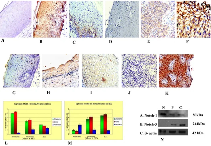 Figure 1. Immuno-histochemical analysis of Notch-1 and Notch-3 showing expression pattern of Notch-1 and Notch-3 in normal, precancerous and cancer tissues of uterine cervix