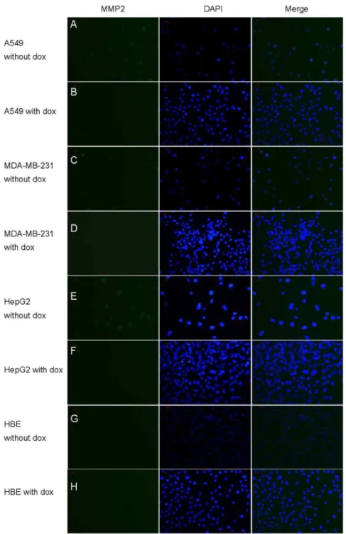 Figure 3. Immunofluorescence analysis of MMP-2 expression in vitro. Immunofluorescence staining for MMP-2 (green) in cytoplasm and nucleus (blue) and merged image (blue-green) in A549, HepG2, MDA-MB-231 and HBE cells SP6200.A, C, E, G show A549, HepG2, MDA