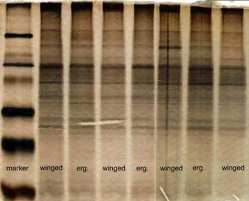 Figure 4. Electrophoresis pattern of the accessory gland extracts after silver staining