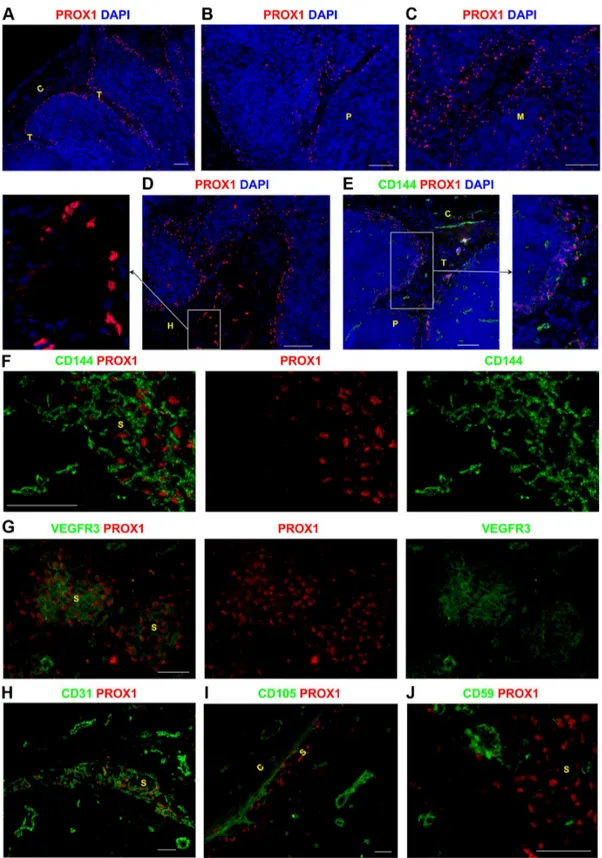 Figure 1. Identifying lymphatic sinuses in the human lymph node using specific markers of lymphatic endothelial cells