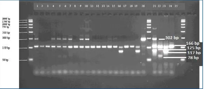 Figure 2. Gel electrophoresis of ampliication products of the multiplex PCR assay for ITS-1.