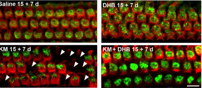 Figure 3. Prx3 siRNA reduces Prx3 expression in OHCs and increases hearing loss in vivo