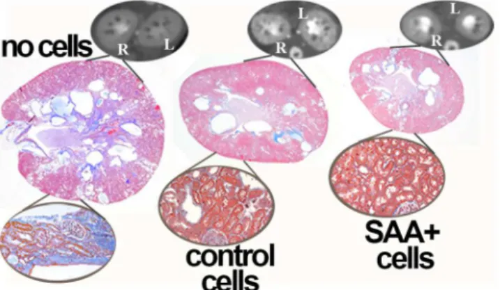 Fig 1. Cytotherapy decreases cyst burden. When compared to no cell transplant groups, treatment of PCK rats wiSAA+ or control cells improves cyst volume and structure at 25 weeks of age