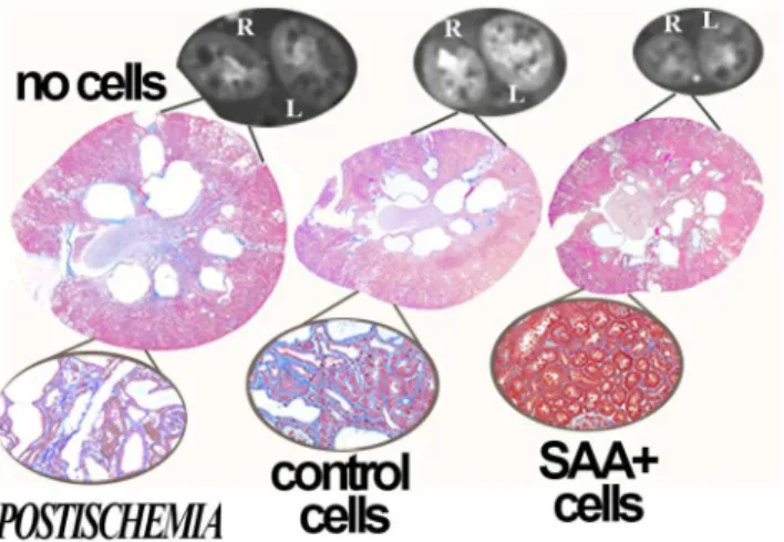 Fig 3. Protection in postischemia kidneys. When compared to no cell transplant groups, treatment of PCK rats with SAA+ or control cells also improves cyst volume and structure in postischemia kidneys at 25 weeks of age, 15 weeks after the final cell infusi