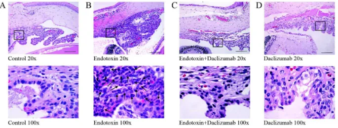 Figure 2. Histopathological changes in the anterior segment 24 h after Daclizumab and/or endotoxin treatment, stained with HE.