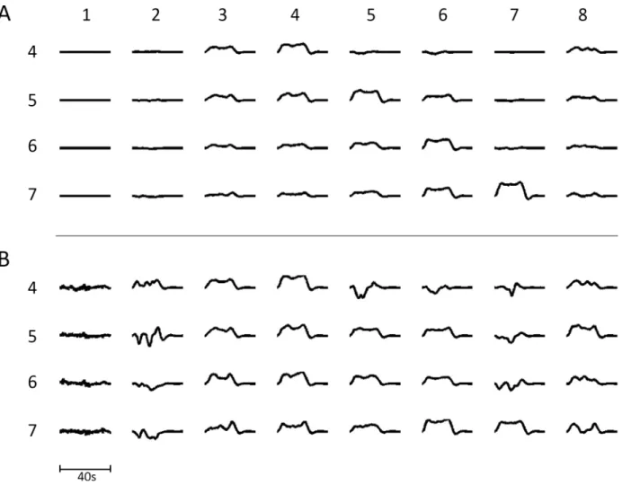 Fig 5. (A) The transient BOLD signal in each module in NI (columns numbered 1 to 8) following successive 20s increases in the subcortical input to modules 4 to 7 (rows numbered 4 to 7), causing increased firing in these modules
