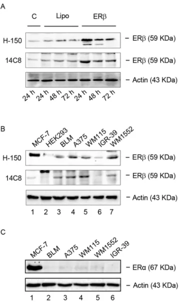 Fig 1. ERβ, but not ERα, is expressed in human melanoma cells. (A) As a positive control, the expression of ERβ was evaluated by Western blot analysis in human BLM melanoma cells engineered to overexpress the receptor subtype protein, utilizing two primary