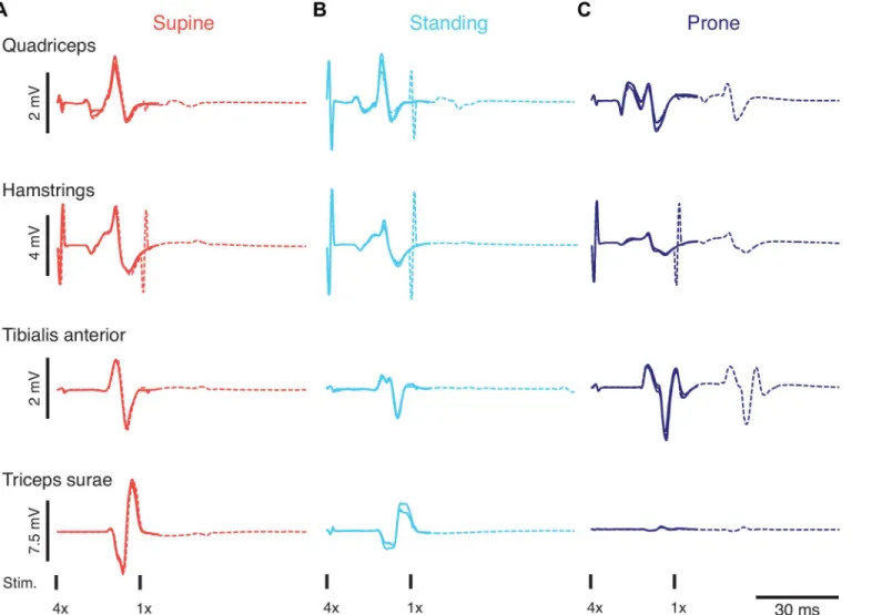Fig 1. Exemplary results. Stimulus time-locked EMG responses elicited in the supine (A), standing (B), and prone position (C) with unchanged stimulation parameters