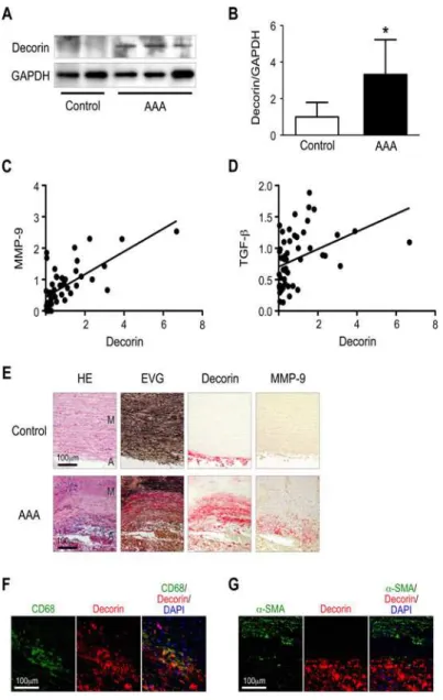 Fig 4. Expression of decorin in human AAA. (A-B) Protein samples were obtained from the aortic walls of human AAA specimens (n = 47) and non-aneurysmal specimens (Control, n = 4)