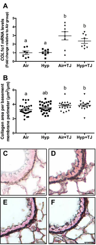 Fig 6. Collagen expression in the lung at P7d and P56d. The mRNA expression of COL1α1 in lung tissue at P7d was significantly greater in the TJ groups compared to the non-TJ groups (A)