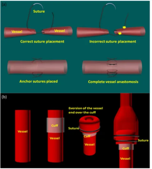 Figure 1. Illustration of microvascular anastomosis procedures. (a) suture based vascular anastomosis;