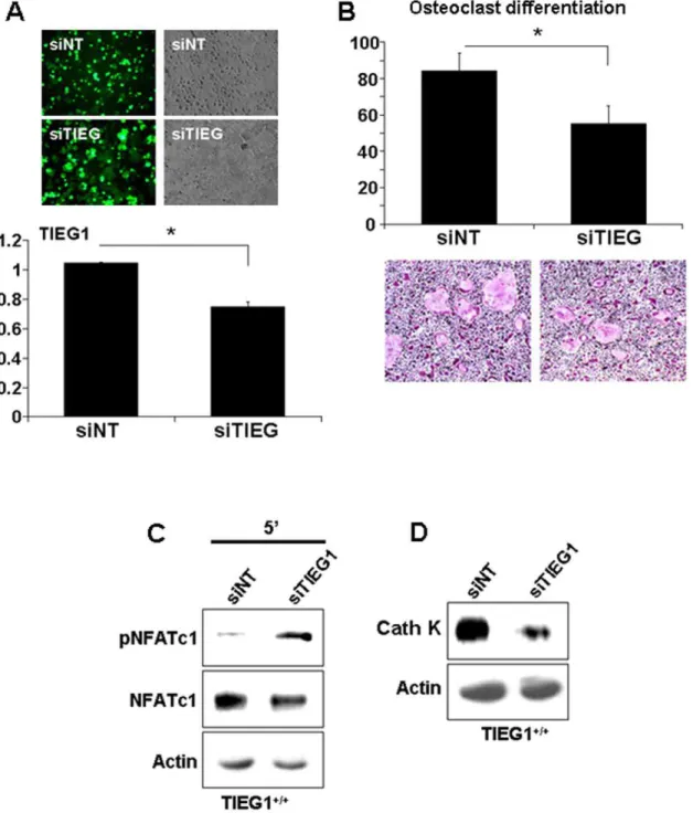 Figure 5. Blockade of TIEG1 expression in WT cells mimics TIEG1 2/2 cell responses. Osteoclast precursors were transfected with accell- accell-siNon-targetting (siNT) or accell-siTIEG1 as detailed in the Methods section