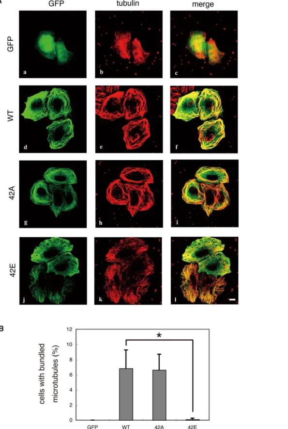 Figure 6. Effect of mutations of DCX at phosphorylation sites on microtubule organization in HeLa cells