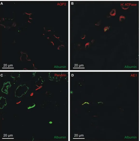 Fig 2. Collecting duct localization of albumin immunoreactivity. Immunofluorescence double-staining was performed for albumin and markers for connecting tubule and collecting duct cells