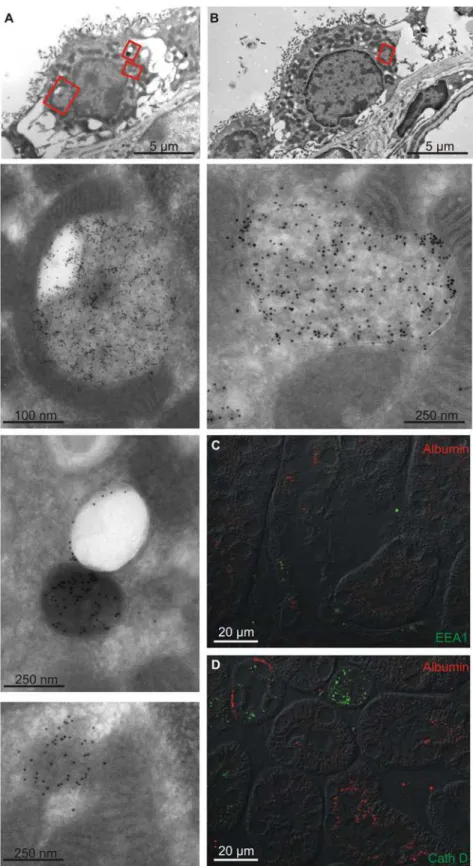 Fig 3. Subcellular localization of albumin in intercalated cells. The subcellular distribution of albumin was assessed by immune-gold electron microscopy and double immunofluorescence histochemistry