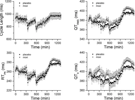 Figure 3. Direct comparison of repolarization measures. Panel A, Bland-Altman plot comparing QT RMS and QT II intervals