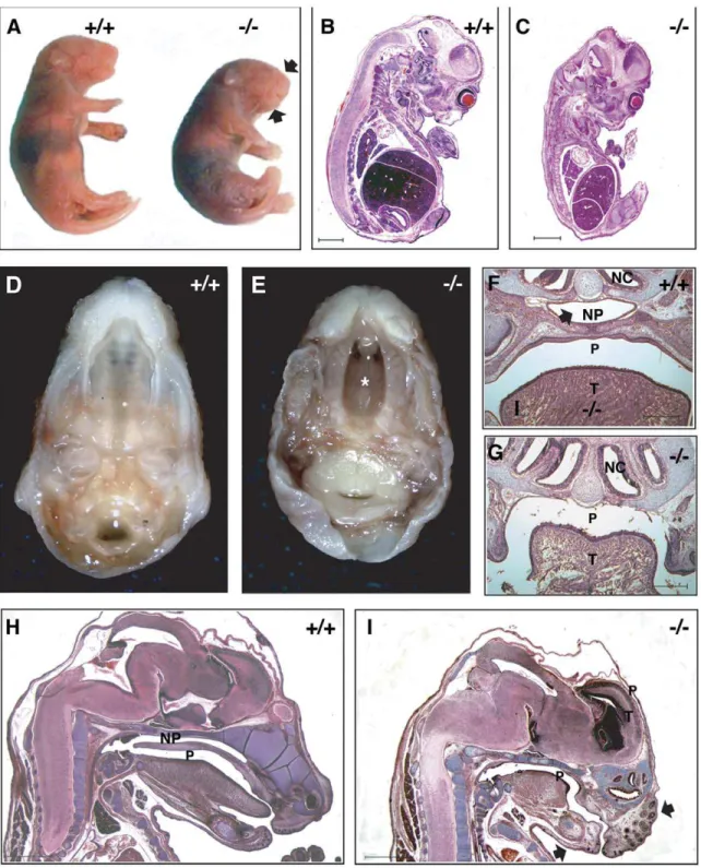 Figure 2. Phenotype of Dlgh-1 2/2 mice. (A) Newborn Dlgh-1 2/2 mice are smaller then their Dlgh-1 +/+ counterparts and have a shortened snout and mandible (arrows)