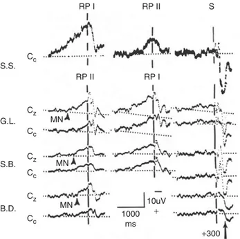 Figure 1.1  Readiness Potentials (RP) Preceding Self-Initiated Voluntary Acts.  Each horizontal row is the  computer-averaged potential for 40 trials, recorded by a DC system with an active electrode on the scalp,  either at the midline-vertex (Cz) or on t
