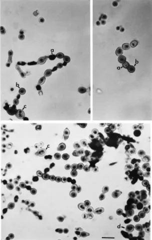 Fig. 2. Conidia nuclei from conidia of A. nidulans strain V10M stained with Giemsa-HCl