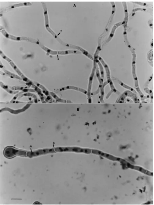 Fig. 3. Nuclear distribution in wild-type and V10M hyphae. The mycelia were grown on cover slips for 19.5 h