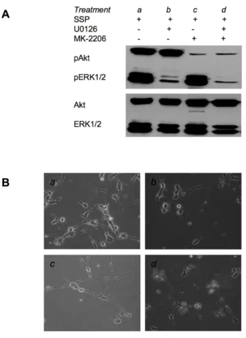 Table 5. RT-PCR analysis of selected gene expression in SCLC cells. Cell line GLC-2 GLC-36 H1184 H146 SCLC-24H Gene ASH-1 + - + + + CD-9 + - + + + Galectin-1 + + + + + Galectin-3 + + + + + GAP-43 + - + - + L1-CAM + - + + + CMYC + - + + + LMYC + - + +  -NMY