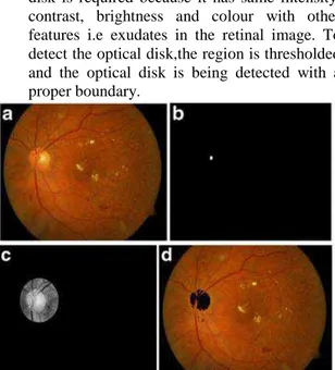 Figure  3:a)  fundus  retinal  image;  b)  dilation  gradient  Image;  c)  thresholded  and  filled  image; 