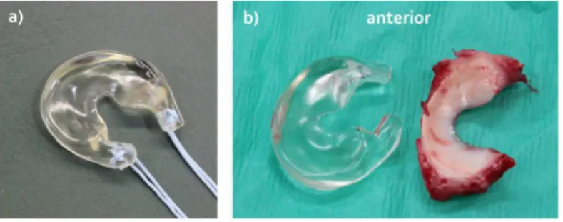 Fig 1. Goat version of the anatomically shaped, polycarbonate urethane (PCU) total medial meniscus replacement