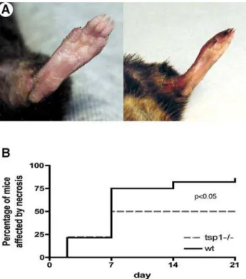 Figure 2. Clinical necrosis is reduced in tsp-12/2 mice. (A) Pictures show mice either protected from necrosis (left) or affected by necrosis (right)