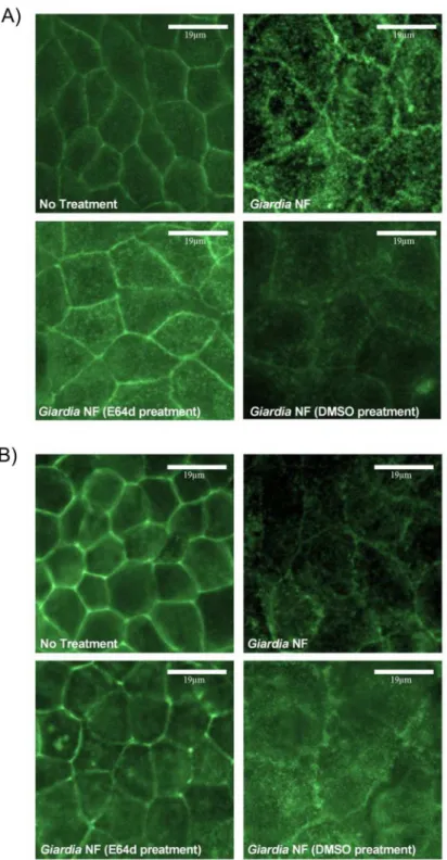 Fig 9. Giardia duodenalis trophozoites produce proteases that are sensitive to inhibition with E-64 that induce disruption of villin within Caco-2 monolayers