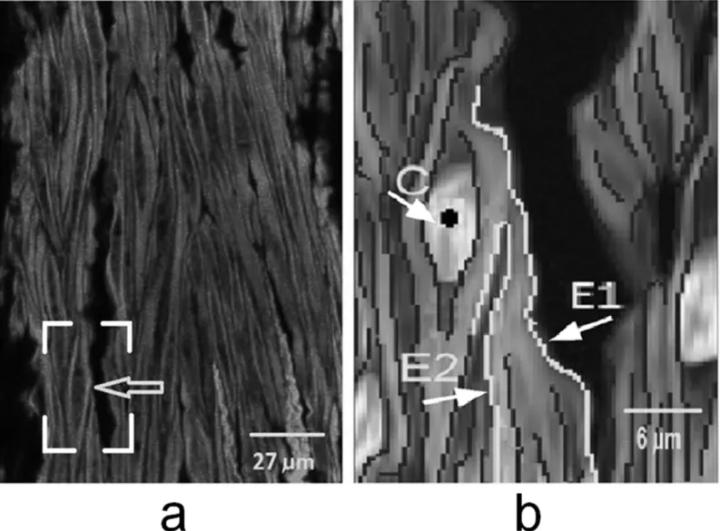 Fig 5. a) Original image, arrow indicates the position of Fig 5b. The nuclei were in darker gray and overlaid from separated image