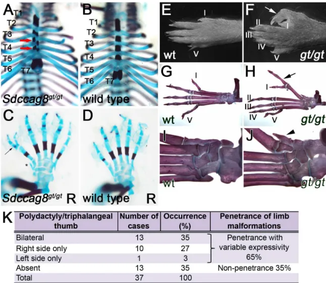 Fig 1. Sdccag8 gt/gt mice exhibit rib cage and pre-axial polydactyly phenotypes. (A–D) Skeletal preparation of E18.5 rib cage and hind limbs, demonstrate misalignment (red arrows) of sternum ossification centers in Sdccag8 gt/gt embryos (A), when compared 