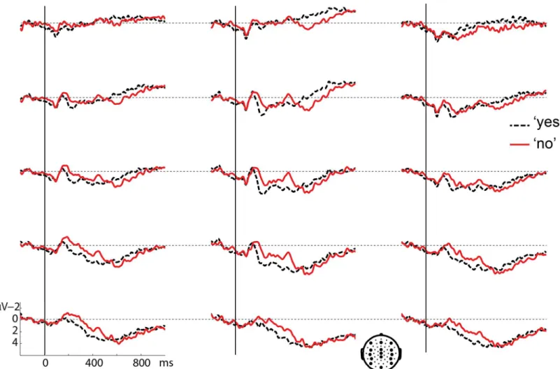 Fig 1. Grand average waveforms for the 'yes' response (black dashed line) and the 'no' response (red solid line) after a 300 ms gap, time-locked to response onset