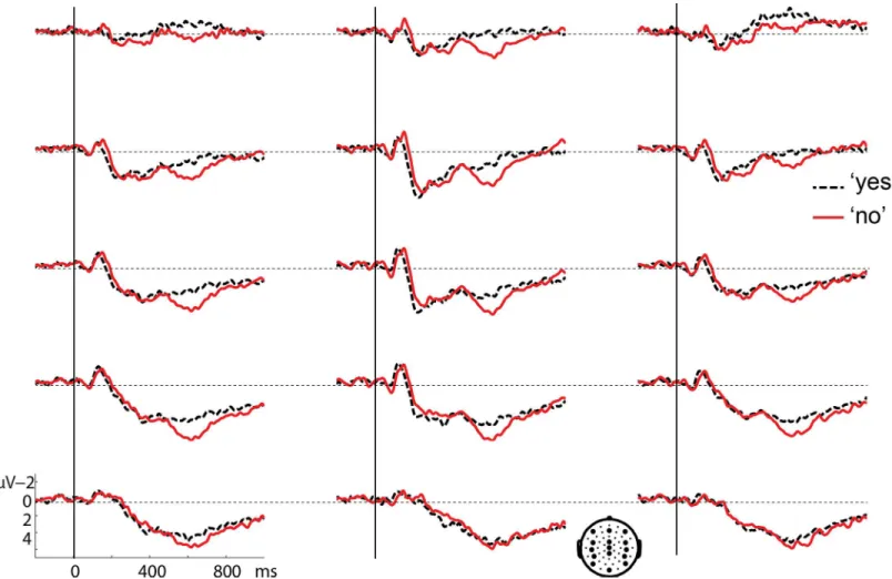 Fig 2. Grand average waveforms for the 'yes' response (black dashed line) and the 'no' response (red solid line) after a 1000 ms gap, time-locked to response onset
