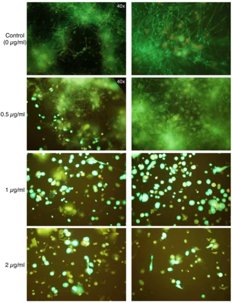 Figure 11. Effect of SM21 treatment in Candida –HOK co-culture model. The viability of co-cultured HOKs and yeast cells in the presence of SM21 was assessed by confocal laser scanning microscopy using fluorescent probes