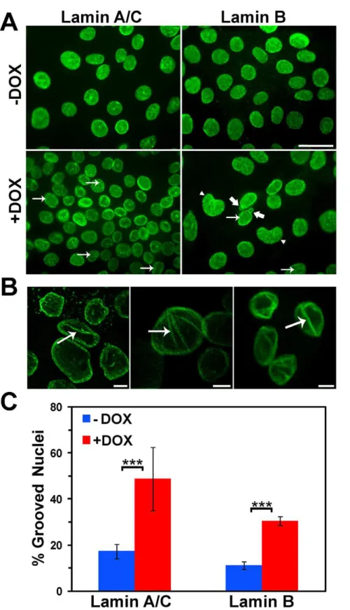 Figure 2. Increased incidence of nuclear grooves occurs in BRG1 knockdown MCF-10A cells