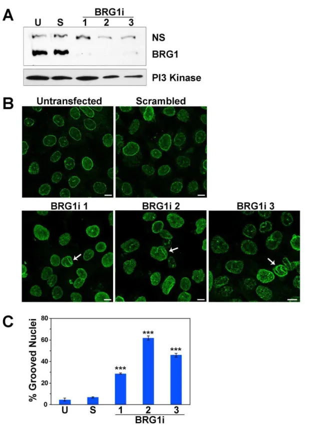 Figure 3. siRNA targeting of BRG1 confirms changes in nuclear shape in MCF-10A cells. (A) Western blot analysis of MCF-10A cells transfected with three different siRNAs that target BRG1 or a control siRNA