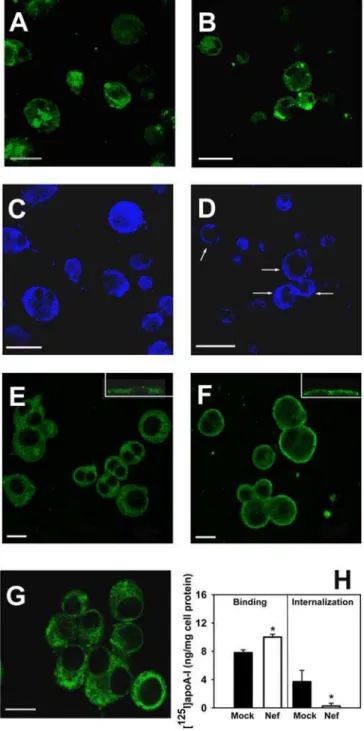 Figure 4A and 4B show p24 staining, and Figure 4C and 4D show ABCA1 distribution in human macrophages infected with DNef and Nef-expressing HIV-1, respectively