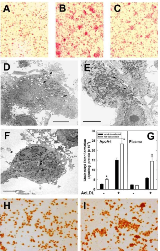 Figure 6. Accumulation of Lipids in Cells Infected with HIV-1 or Transfected with Nef