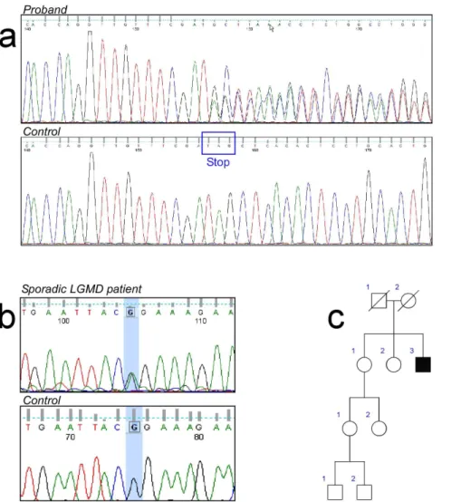 Figure 2. Sequence analyses of the TNPO3 mutations. a) Heterozygous delA mutation in Exon 22 of the TNPO3 gene in Proband VII-5