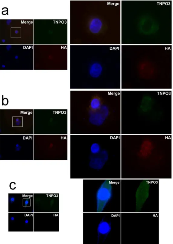 Figure 4. Indirect immunofluorescence analysis of the wt-hTNPO3 compared with delA p.X924C -hTNPO3