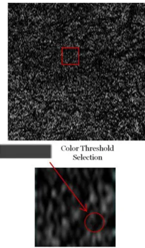 Figure 3. Selecting Pixel Intensity Threshold for Choroidal Vessel Density Analysis. Choroidal C-scans (top image) were obtained using the advanced visualization feature of macular cubes consisting of 5126128 optical coherence tomography volume scans over 