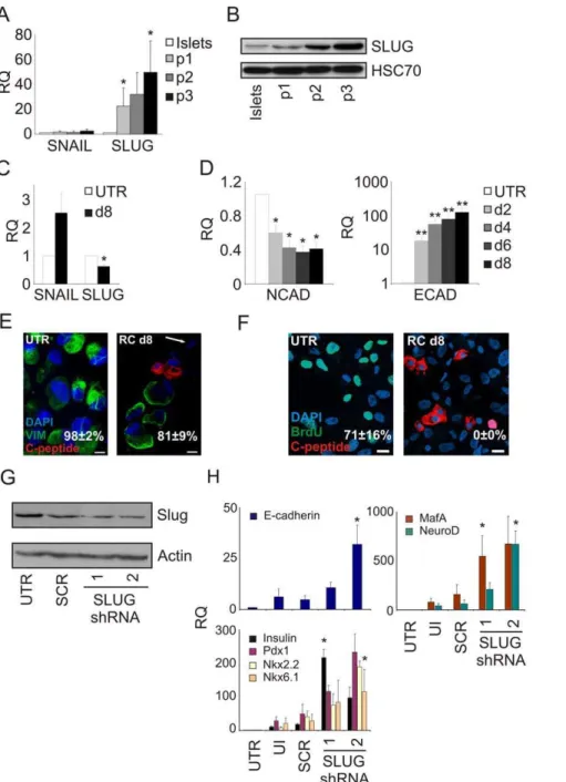 Figure 4. BCD cell redifferentiation involves MET. A,B: Induction of SLUG expression during islet cell dedifferentiation