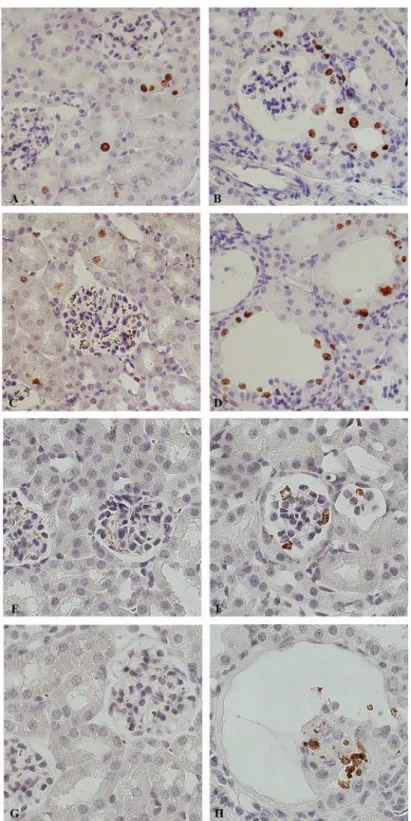 Fig 6. High cellular turnover precedes the development of cysts. Representative pictures of renal cortex from 30 (A, B, E, F) and 50 day old mice (C, D, G, H)