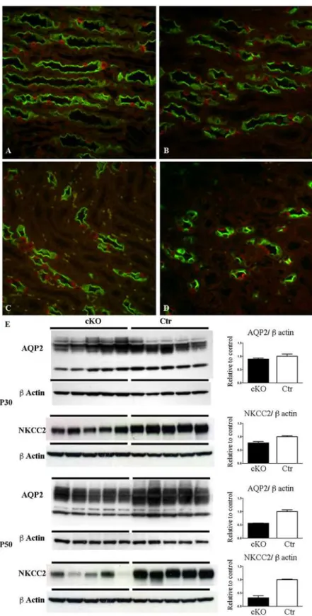 Fig 3. Dicer suppression is associated with downregulation of AQP2, NKCC2 and lower density of collecting ducts