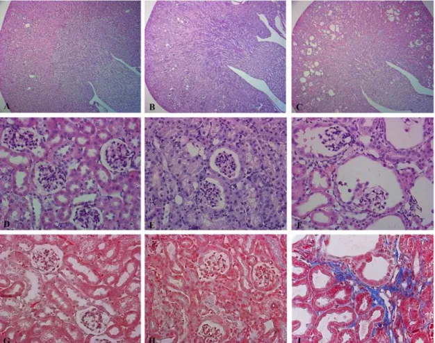 Fig 4. Suppression of Dicer leads to a glomerulocystic disease. Representative pictures of hematoxylin and eosin (A-F) and Masson’s Trichrome (G,I).