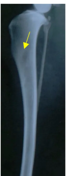 Figura 3 - Radiografia na posição mediolateral da tíbia de um animal do grupo  controle, 180 dias após a cirurgia