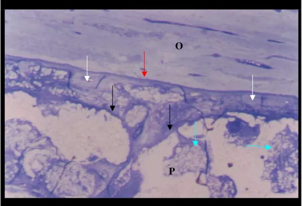Figura 12. Interface polímero(P) /tecido ósseo (O). Proliferação do tecido conjuntivo  fibroso (setas pretas) e crescimento ósseo imaturo (setas brancas), linha  de cimentação (seta vermelha), tecido conjuntivo fibroso sobre o  polímero (setas azuis)