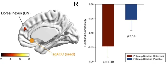 Figure 5. Functional connectivity across the whole experiment. The bar diagrams represent the functional connectivity (Fisher z-transformed correlation values after global mean regression) for the following experimental conditions: baseline and follow-up (