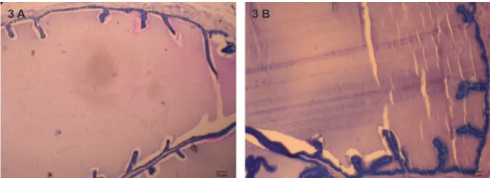 Fig 3: T.S. of the Seminal vesicles of control (A) to show normal histological features (B) MTZ (500 mg/kgBW/day)-treated  mouse for 28 days showing unaltered histology.